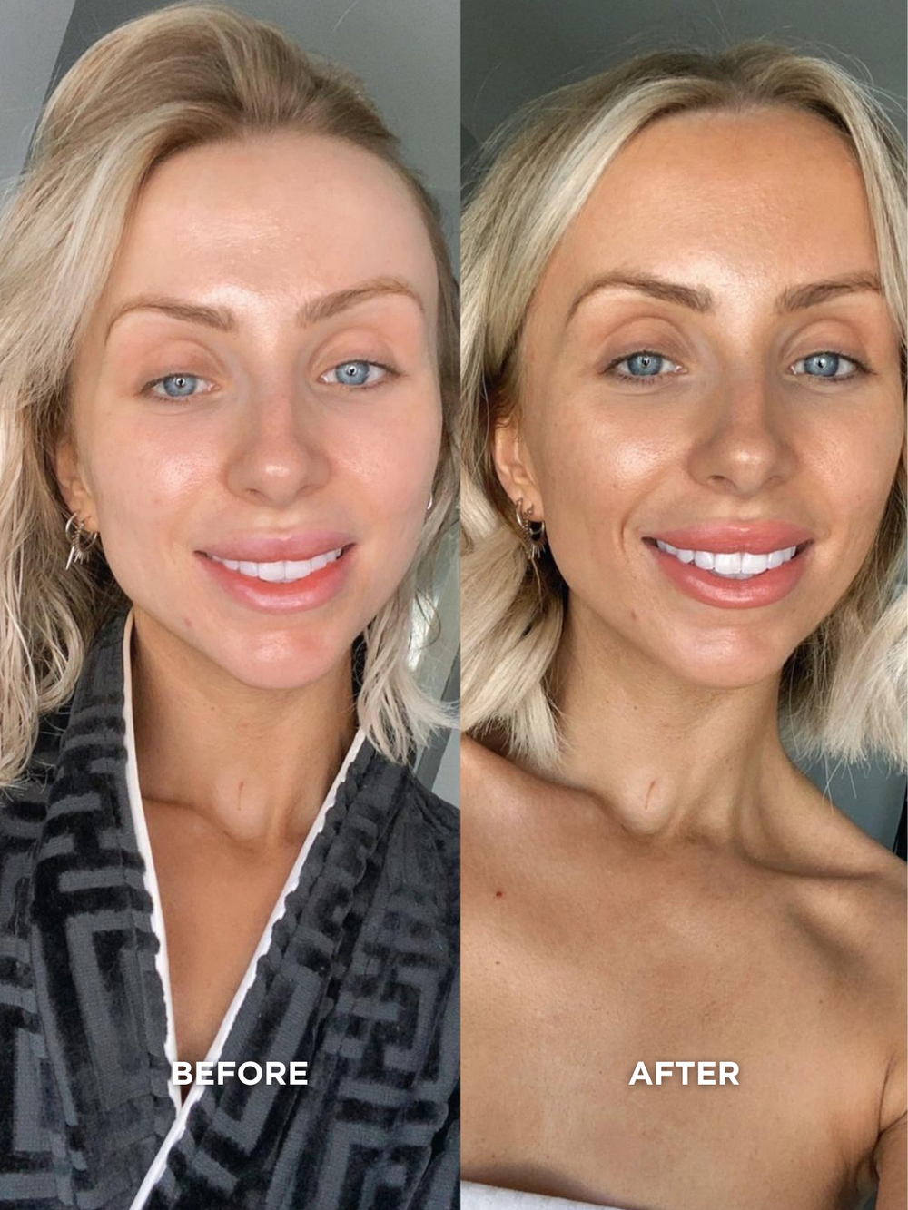 Wonder Water | Dripping Gold